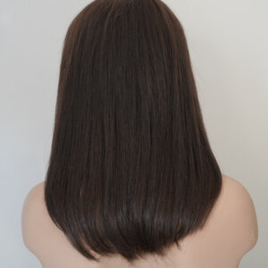 Начало 31 алопеция бюджетни до рамото права