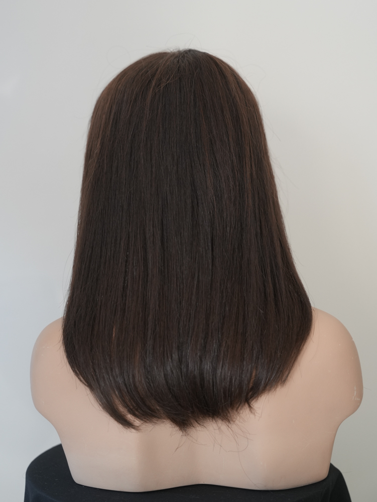 алопеция-бюджетни-до рамото-права