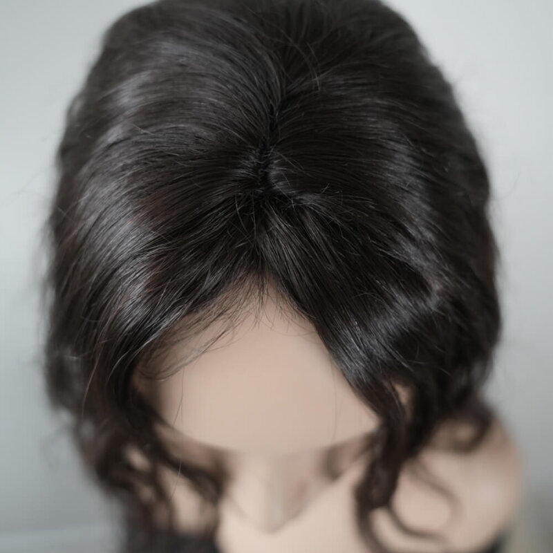 алопеция-косопад-бюджетна-купува-продава